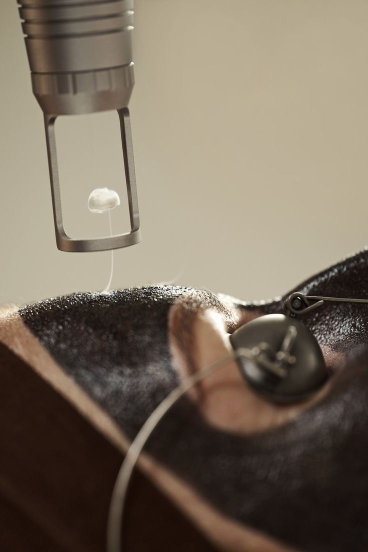 Carbon laser treatment at Skinnish salon Mangalore, Uppala, Ullal for pigmentation and acne care