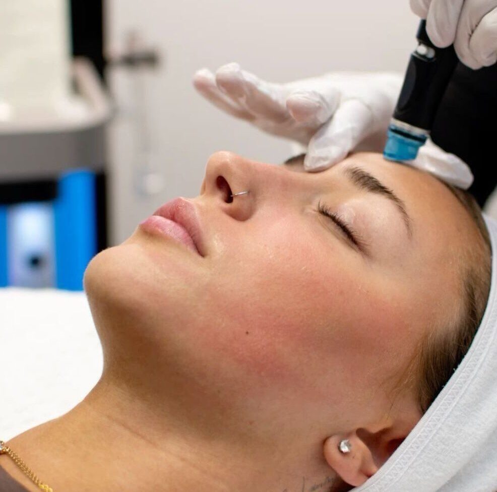 Advance Hydra Facial treatment at Skinnish Aesthetic Clinic Mangalore – deep cleansing, hydration, and glowing skin care in Ullal and Uppala.